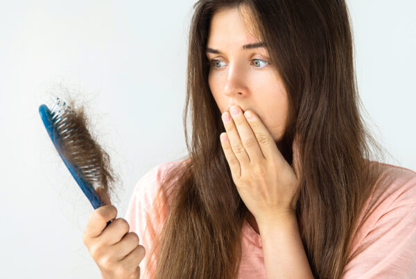 Caduta dei capelli cause - Centro Tricologico Treviso FM
